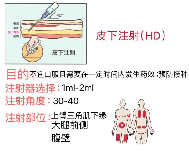 穴位注射的操作步骤