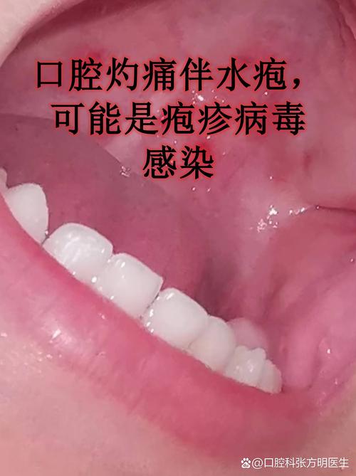 天津中医疱疹就找津门