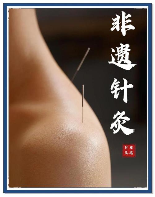 中医针灸可以每天针吗