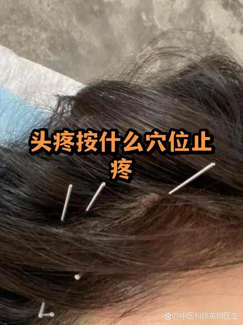 头疼恶心按哪个穴位