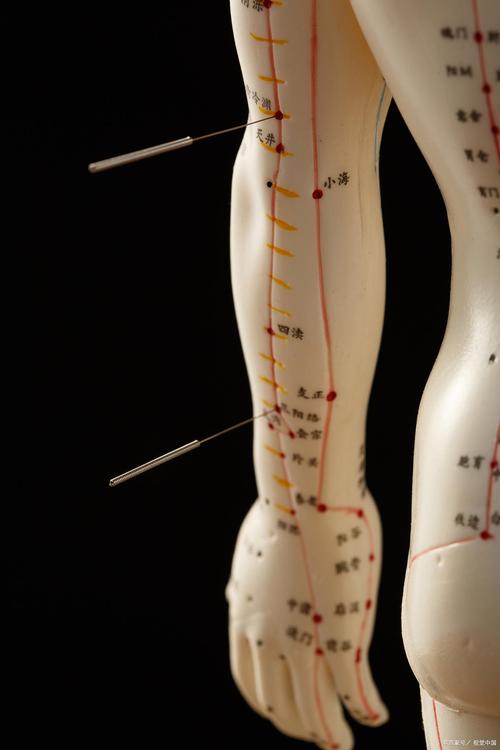 发烧的针灸治疗穴位