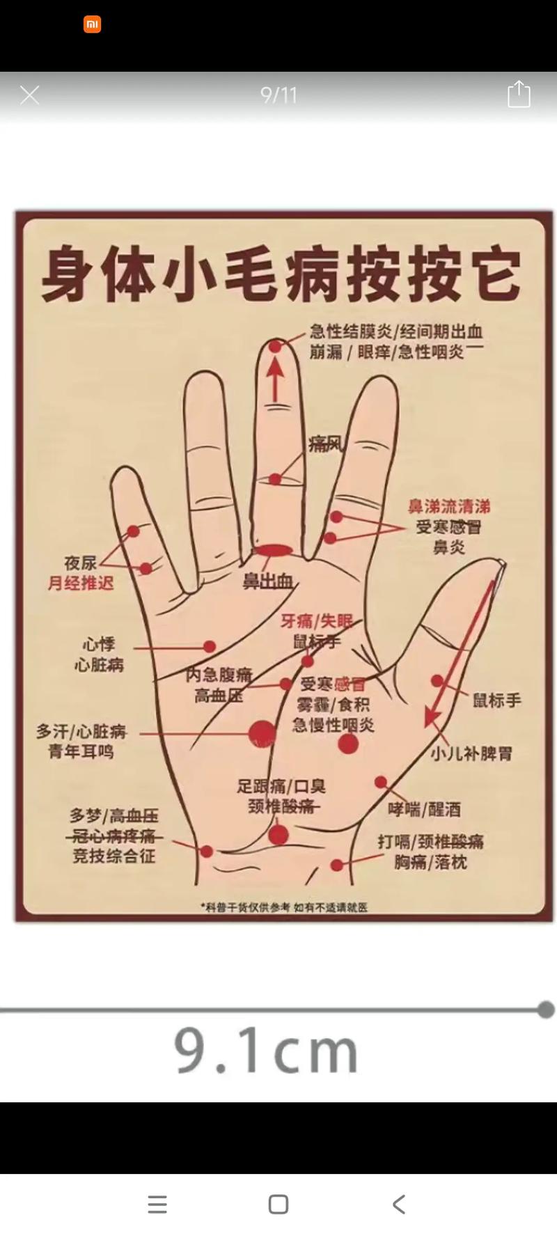 中医手掌按压穴位图