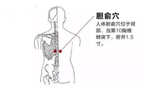 胆结石 按穴位 图