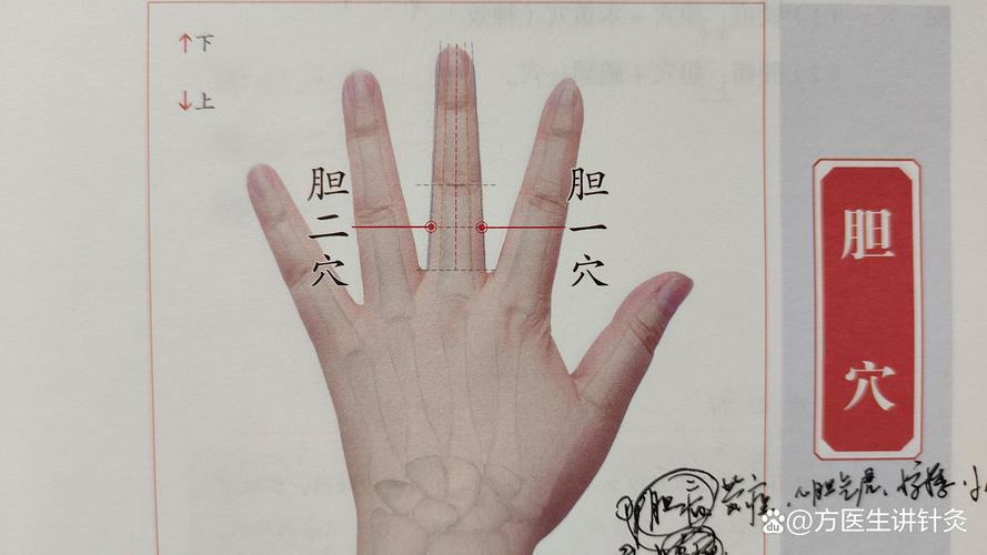 胆结石 按穴位 图