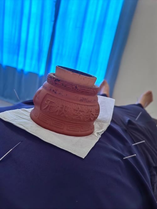 中医院针灸一次200