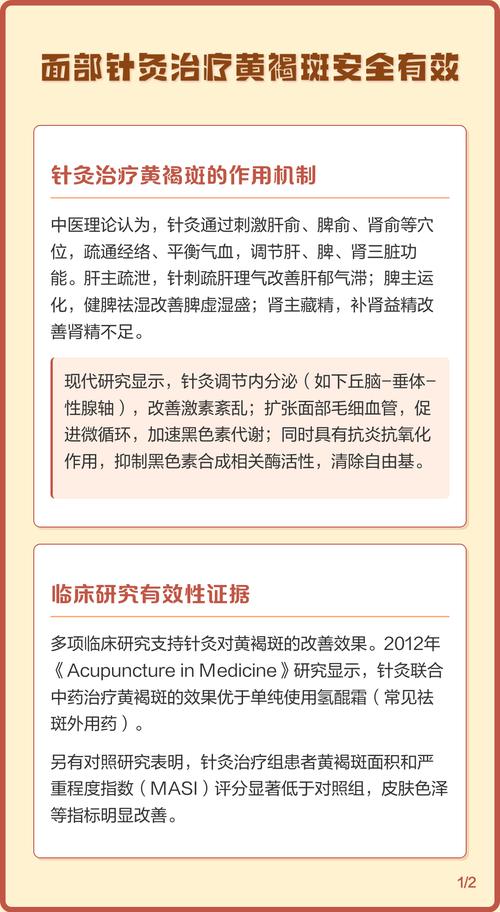 中医治疗黄褐斑有奇效