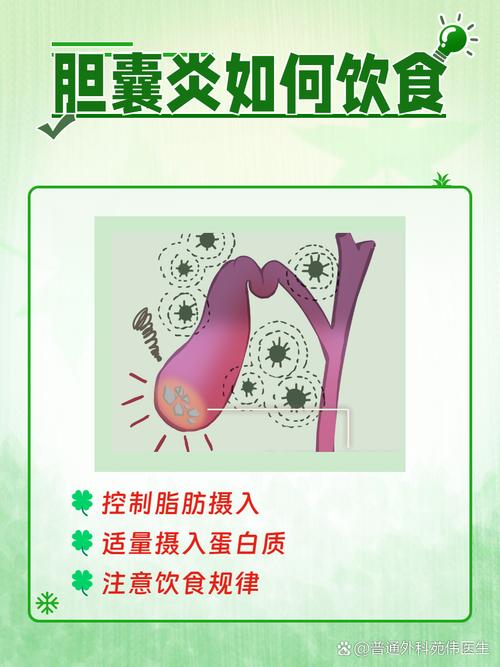 胆囊发炎饮食注意事项