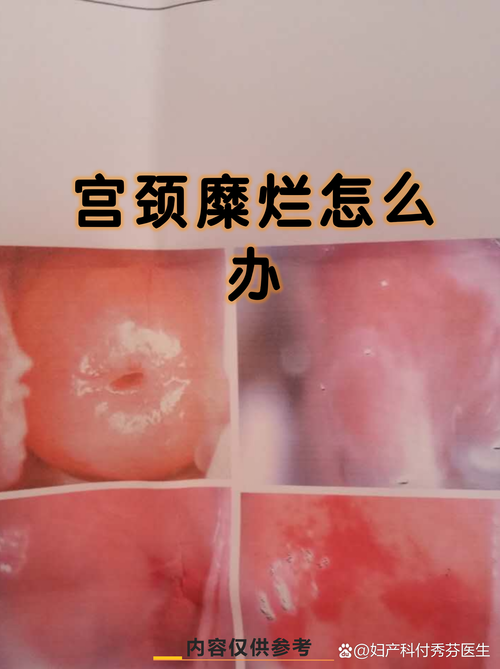 安阳中医院妇科怎么样