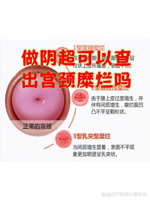 安阳中医院妇科怎么样