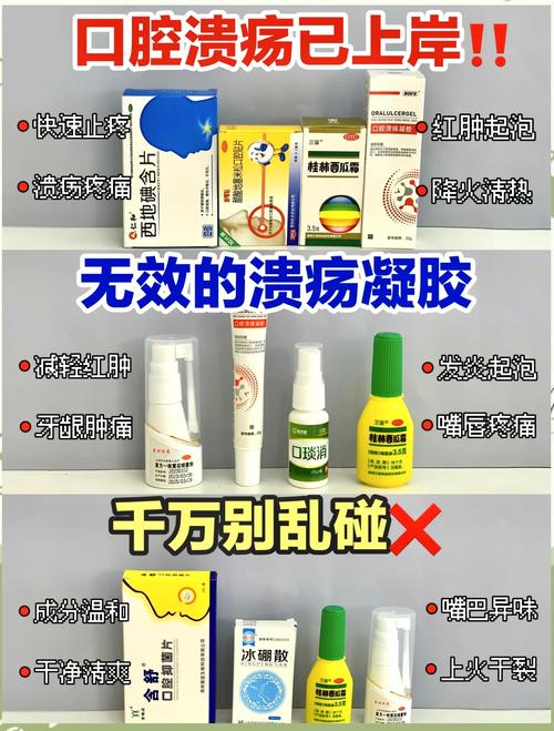 中医治疗口腔溃疡名方