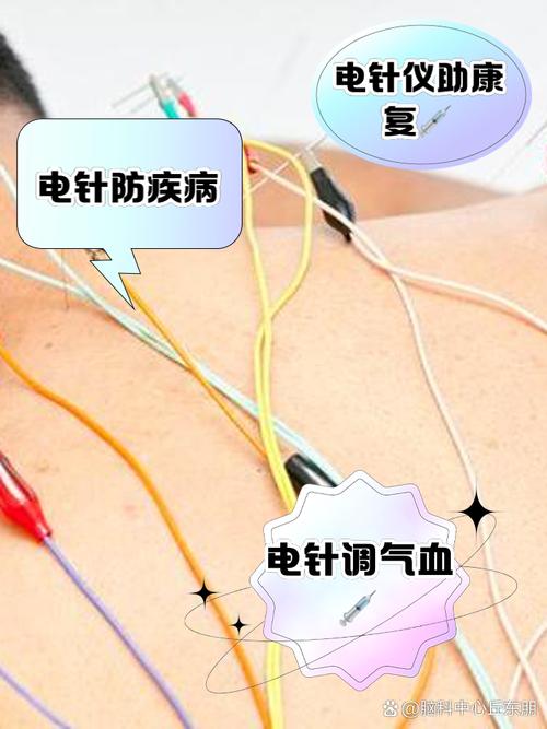 微电流 对人体穴位