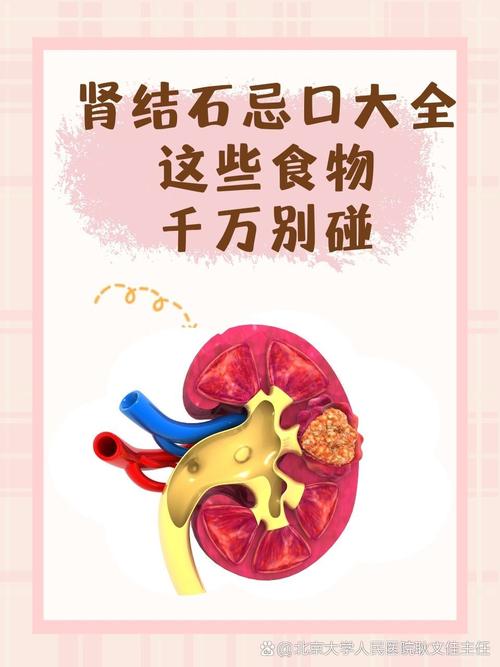 结石平时饮食注意事项