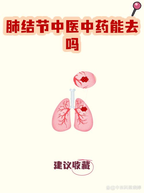 中医治疗肺结节病效果