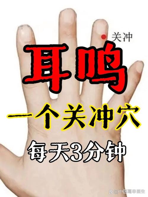 耳鸣针灸穴位有哪些