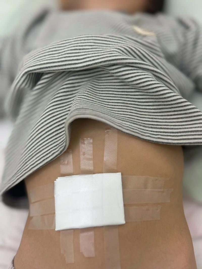 中医保胎贴有什么作用