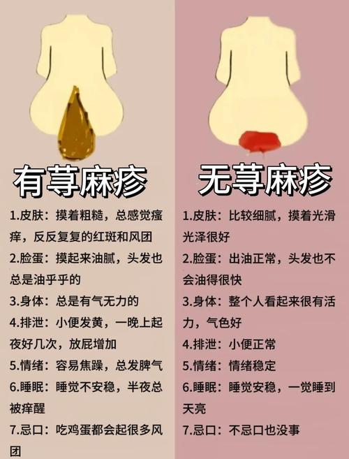 起风疙瘩饮食注意什么