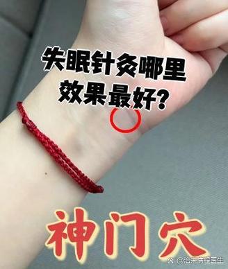 失眠针灸扎穴位哪里