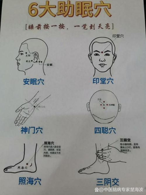 失眠针灸扎穴位哪里