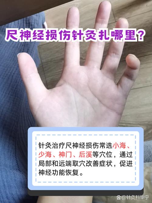 针刺穴位的肌体反应