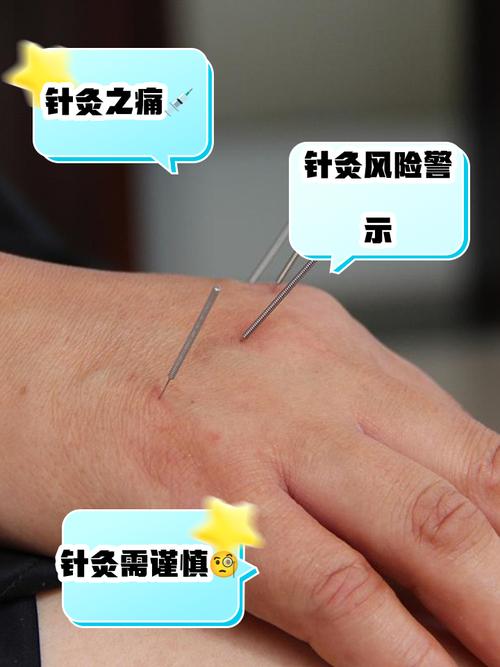 针刺穴位的肌体反应