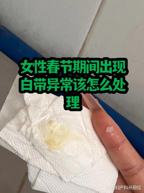 白带异常饮食注意什么