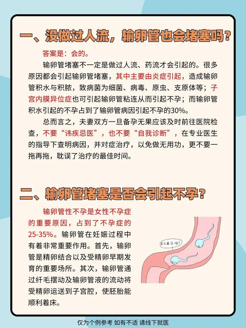 中医治输卵管通而不畅