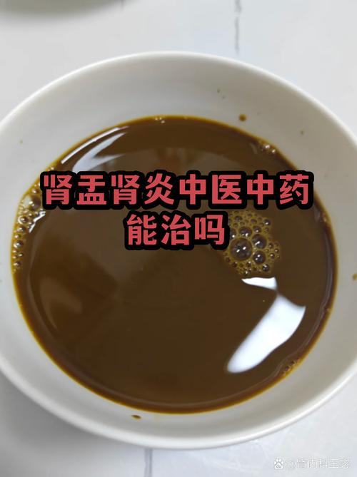 我的肾炎被中医治好了