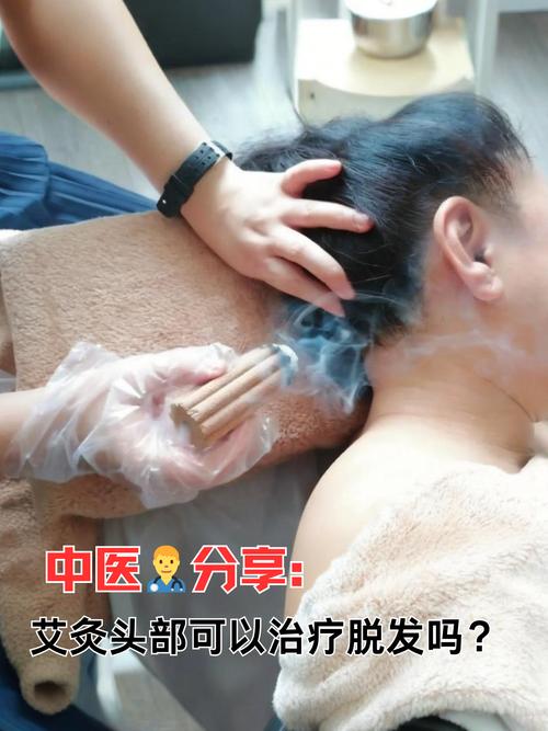 头顶穴位可以艾灸吗
