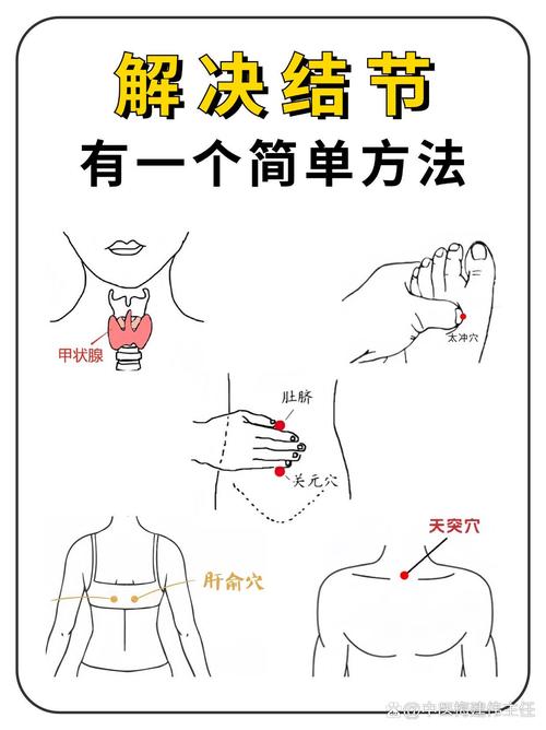 甲状腺结节按哪穴位