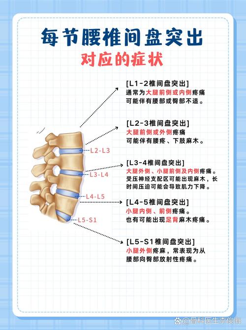 腰椎间盘突出中医解释