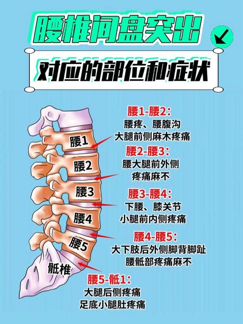腰椎间盘突出中医解释
