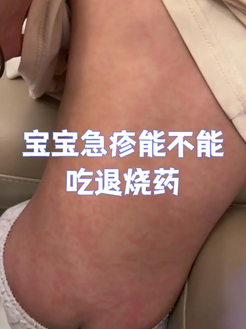 病毒性感冒宝宝的饮食
